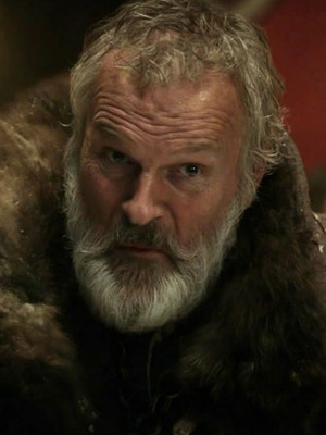 'Game of Thrones' Actor's Ear Bitten Off in Hotel Attack