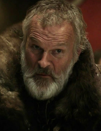 'Game of Thrones' Actor's Ear Bitten Off in Hotel Attack