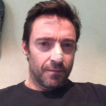 hugh-jackman-340x440