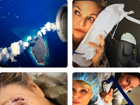 Ow! Christie Brinkley Airlifted to Hospital After Bird Accident
