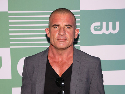 Dominic Purcell in Major Accident on 'Prison Break' Set (Warning: Graphic Images)